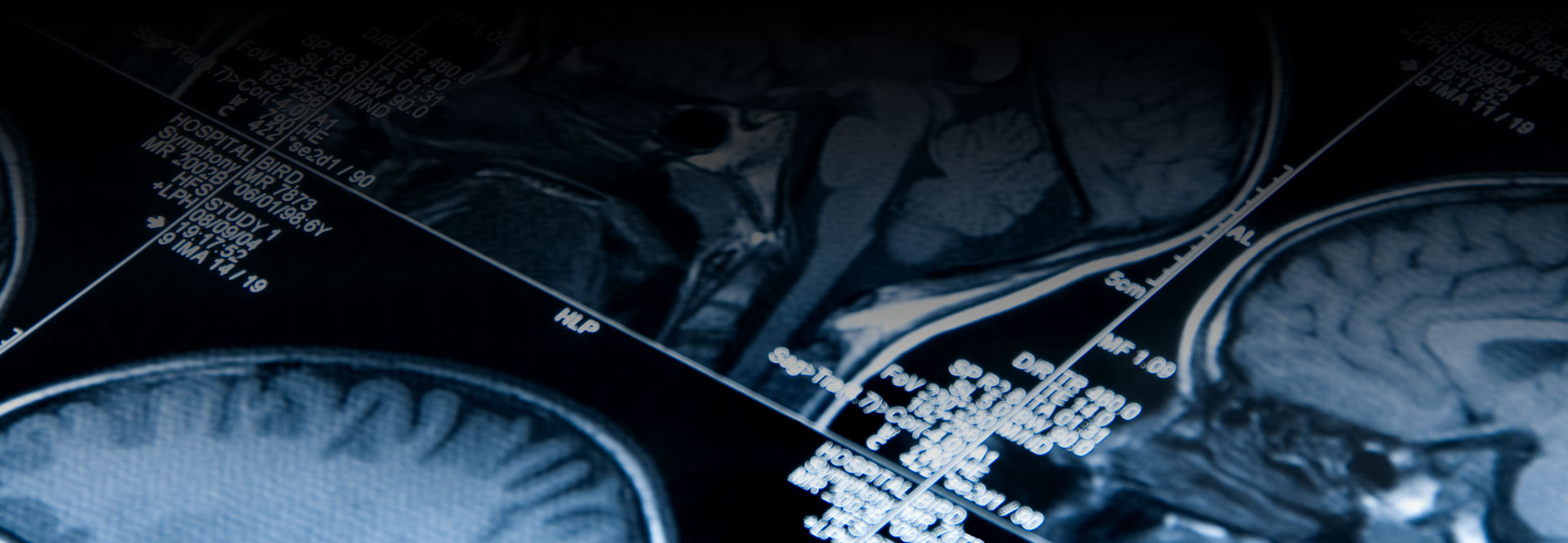 Denver Traumatic Brain Injury Lawyer | Help During a Crisis