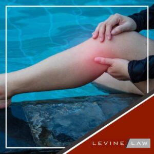 Denver Swimming Pool Accident Lawyer